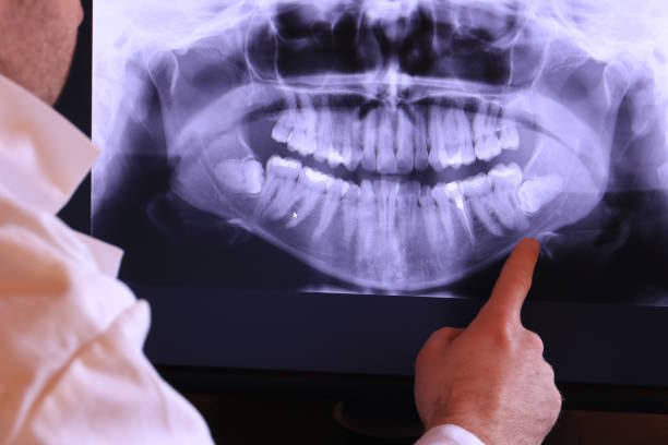 Best Emergency Root Canal Treatment in Encantada Ranchito El Calaboz, TX