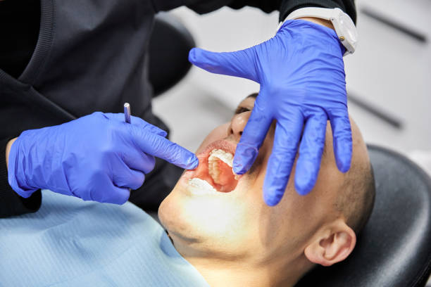 Best Emergency Wisdom Teeth Removal in Encantada Ranchito El Calaboz, TX